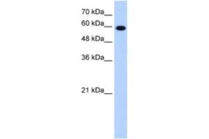 Western Blotting (WB) image for anti-Stress-Induced-phosphoprotein 1 (STIP1) antibody (ABIN2462951) (STIP1 抗体)
