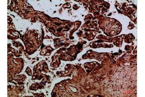 Immunohistochemical analysis of paraffin-embedded Human-placenta, antibody was diluted at 1:100 (NAIP 抗体  (AA 1191-1240))