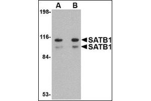 Western blot analysis of SATB1 in SK-N-SH cell lysate with this product at (A) 1 and (B) 2 μg/ml. (SATB1 抗体  (N-Term))