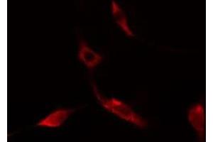 ABIN6275521 staining NIH-3T3 cells by IF/ICC. (Septin 14 抗体  (C-Term))