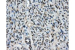 Immunohistochemical staining of paraffin-embedded Kidney tissue using anti-BRAFmouse monoclonal antibody. (BRAF 抗体)