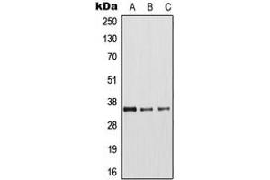 Western blot analysis of Arginase 1 expression in MCF7 (A), mouse liver (B), rat kidney (C) whole cell lysates.