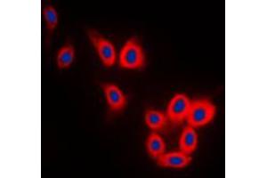 Immunofluorescent analysis of TAU staining in SKNSH cells. (tau 抗体  (C-Term))
