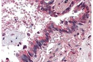 Formalin-Fixed, Paraffin-Embedded Human Lung stained with BMP4 antibody at 5 µg/ml after heat-induced antigen retrieval. (BMP4 抗体)