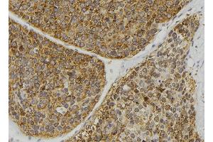 ABIN6269391 at 1/100 staining Human pancreas tissue by IHC-P. (ASK1 抗体  (N-Term))