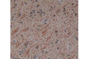 Used in DAB staining on fromalin fixed paraffin- embedded Kidney tissue (ICK 抗体  (AA 1-284))