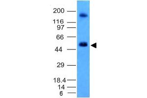 Western Blot Analysis of HCT116 cell lysate CAIX Mouse Monoclonal Antibody (CA9/781). (CA9 抗体)