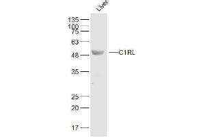 Mouse liver lysates probed with C1RL Polyclonal Antibody, Unconjugated  at 1:500 dilution and 4˚C overnight incubation. (C1RL 抗体  (AA 101-200))