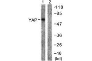Western blot analysis of extracts from HepG2 cells, treated with Wortmannin 40nM 24h, using YAP (Ab-127) Antibody. (YAP1 抗体  (AA 93-142))