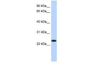 NKAIN4 antibody used at 1 ug/ml to detect target protein. (NKAIN4 抗体  (N-Term))