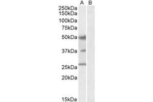 Image no. 1 for anti-Forkhead Box A1 (FOXA1) (C-Term) antibody (ABIN374334) (FOXA1 抗体  (C-Term))