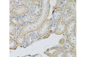 Immunohistochemistry of paraffin-embedded Rat kidney using MSLN Polyclonal Antibody at dilution of 1:100 (40x lens). (Mesothelin 抗体)