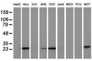 Image no. 4 for anti-Adenylate Kinase 4 (AK4) antibody (ABIN1496530) (AK4 抗体)