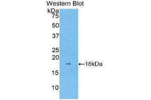 Western Blotting (WB) image for anti-Lecithin-Cholesterol Acyltransferase (LCAT) (AA 290-433) antibody (Biotin) (ABIN1176764) (LCAT 抗体  (AA 290-433) (Biotin))