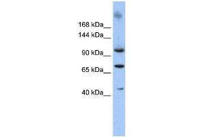 WB Suggested Anti-TUT1 Antibody Titration: 0. (TUT1 抗体  (N-Term))