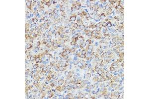 Immunohistochemistry (IHC) image for anti-Abl-Interactor 1 (ABI1) (AA 180-230) antibody (ABIN7265359)