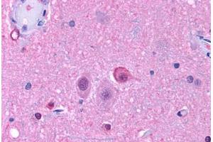 Anti-NPY5R antibody  ABIN1049127 IHC staining of human brain, neurons and glia. (NPY5R 抗体  (Cytoplasmic Domain))