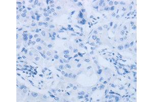 Immunohistochemistry (IHC) image for anti-Matrix Metallopeptidase 25 (MMP25) antibody (ABIN1873725) (MMP25 抗体)