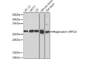 Western blot analysis of extracts of various cell lines, using Hippocalcin (HPCA) (HPCA) Rabbit mAb (ABIN7267653) at 1:1000 dilution. (Hippocalcin 抗体)