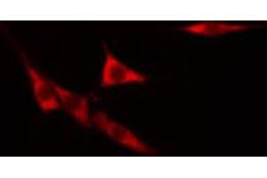 ABIN6268773 staining hacat cells by IF/ICC. (KRT14 抗体  (N-Term))