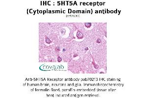 Image no. 1 for anti-Serotonin Receptor 5A (HTR5A) (3rd Cytoplasmic Domain) antibody (ABIN1731379) (Serotonin Receptor 5A 抗体  (3rd Cytoplasmic Domain))