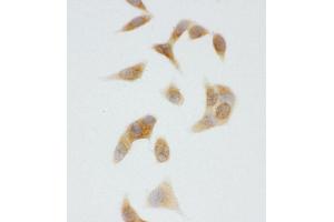 Immunohistochemistry (IHC) image for anti-Cytochrome P450, Family 2, Subfamily U, Polypeptide 1 (CYP2U1) (AA 457-473), (C-Term) antibody (ABIN3044054)