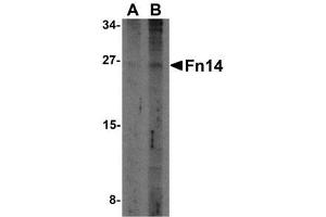Western blot analysis of Fn14 in HepG2 cells with AP30344PU-N Fn14 antibody at (A) 2 and (B) 4 μg/ml. (TNFRSF12A 抗体)