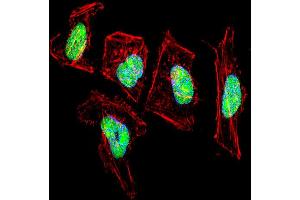 Fluorescent confocal image of Hela cell stained with NFIC Antibody . (NFIC 抗体  (AA 180-208))