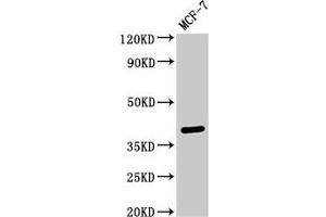 Western Blot Positive WB detected in: MCF-7 whole cell lysate All lanes: SFRP4 antibody at 3 μg/mL Secondary Goat polyclonal to rabbit IgG at 1/50000 dilution Predicted band size: 40 kDa Observed band size: 40 kDa (SFRP4 抗体  (AA 293-346))