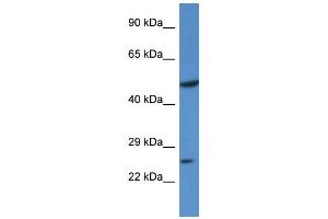 Western Blotting (WB) image for anti-Kruppel-Like Factor 17 (KLF17) (N-Term) antibody (ABIN2778556) (KLF17 抗体  (N-Term))