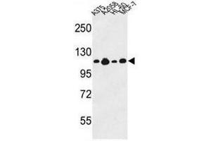 Western blot analysis of COL17A1 Antibody (Center) in A375, A2058, HL-60, MCF-7 cell line lysates (35µg/lane). (COL17A1 抗体  (Chain alpha 1, Middle Region))