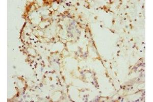 Immunohistochemistry (IHC) image for anti-Casein Kinase 1, gamma 1 (CSNK1G1) (AA 298-422), (Isoform gamma 1) antibody (ABIN7146875)