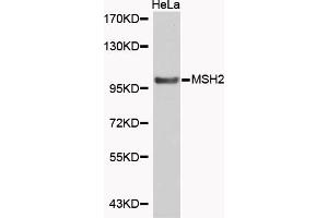 Western blot analysis of extracts of HeLa cells, using MSH2 antibody (ABIN5969993). (MSH2 抗体)