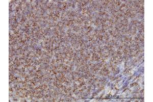 Immunoperoxidase of monoclonal antibody to ADD1 on formalin-fixed paraffin-embedded human tonsil. (alpha Adducin 抗体  (AA 1-662))