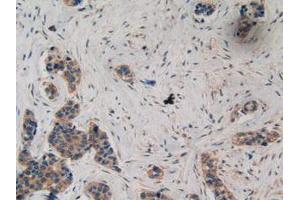IHC-P analysis of Human Breast Tissue, with DAB staining. (Ataxin 1 抗体  (AA 569-807))