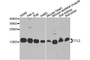 Western blot analysis of extracts of various cell lines, using CFL2 antibody. (Cofilin 2 抗体  (AA 1-166))
