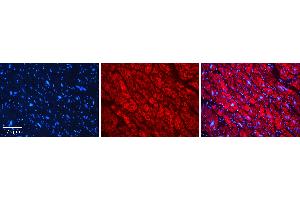 Immunohistochemistry (IHC) image for anti-STIP1 Homology and U-Box Containing Protein 1 (STUB1) (C-Term) antibody (ABIN2774917)