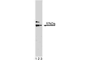 Western blot analysis of hILP/XIAP on Jurkat lysate. (XIAP 抗体  (AA 268-426))