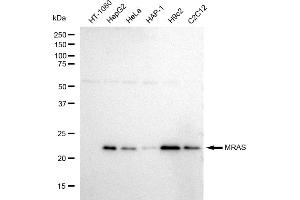 Western blotting analysis using MRAS antibody (ABIN7799496).