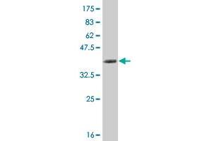 Western Blot detection against Immunogen (35. (NFKBIB 抗体  (AA 56-145))