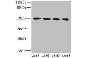 Western blot All lanes: TUBB2A antibody at 14 μg/mL Lane 1: MCF-7 whole cell lysate Lane 2: Hela whole cell lysate Lane 3: HepG2 whole cell lysate Lane 4: MDA-MB-231 whole cell lysate Secondary Goat polyclonal to rabbit IgG at 1/10000 dilution Predicted band size: 50 kDa Observed band size: 50 kDa (TUBB2A 抗体  (AA 1-445))