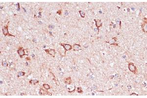 Immunohistochemistry of paraffin-embedded Mouse spinal cord using ENTPD6 Polyclonal Antibody at dilution of 1:100 (40x lens). (ENTPD6 抗体)