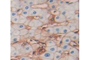 IHC-P analysis of Human Tissue, with DAB staining. (SLC1A5 抗体  (AA 327-541))