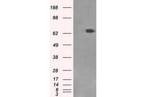Western Blotting (WB) image for anti-X-Ray Repair Complementing Defective Repair in Chinese Hamster Cells 1 (XRCC1) antibody (ABIN1501769) (XRCC1 抗体)