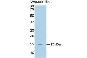 Western Blotting (WB) image for anti-Single Immunoglobulin and Toll-Interleukin 1 Receptor (TIR) Domain (SIGIRR) (AA 1-118) antibody (ABIN1171738)