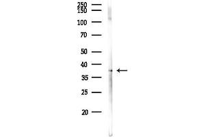 anti-Protein Phosphatase 1, Regulatory Subunit 42 (PPP1R42) antibody