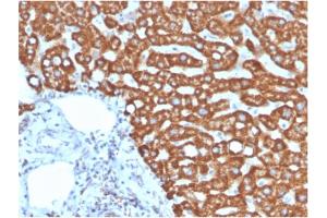 Formalin-fixed, paraffin-embedded human liver in colon stained with Heat Shock Protein 60 Mouse Monoclonal Antibody (HSPD1/875). (HSPD1 抗体)