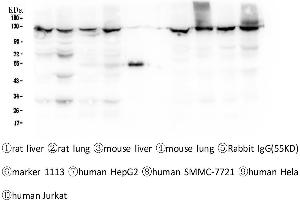 Western blot analysis of CRM1 using anti-CRM1 antibody . (XPO1 抗体  (AA 966-1071))