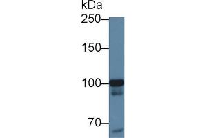 Western Blot; Sample: Human Hela cell lysate; Primary Ab: 1µg/ml Rabbit Anti-Human MARS Antibody Second Ab: 0. (MARS 抗体  (AA 74-198))