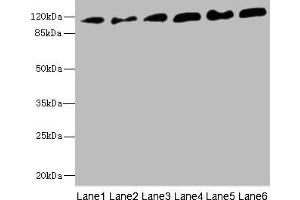 Western blot All lanes: PCDH1 antibody at 2. (Protocadherin 1 抗体  (AA 60-220))